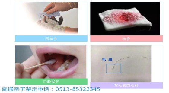 南通本地亲子鉴定机构在哪里/南通个人亲子鉴定怎么做？